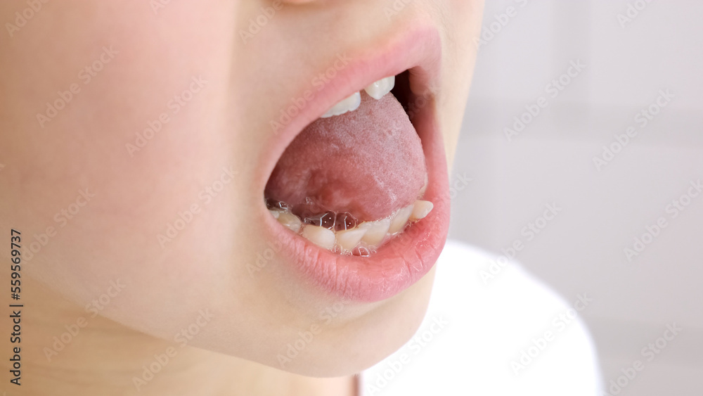 Obraz premium Child shows his loose milk tooth presses and pushes it with his tongue. Open mouth close-up. Caucasian 6 year old kid in a white T-shirt on a bathroom background. lower incisor. Copy space. Body part