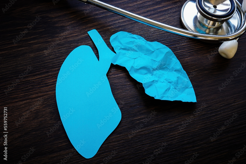 Stethoscope and one crumpled paper lung as a ground glass opacity after