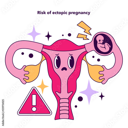 Risk of ectopic pregnancy as a disadvantage of In vitro fertilization.