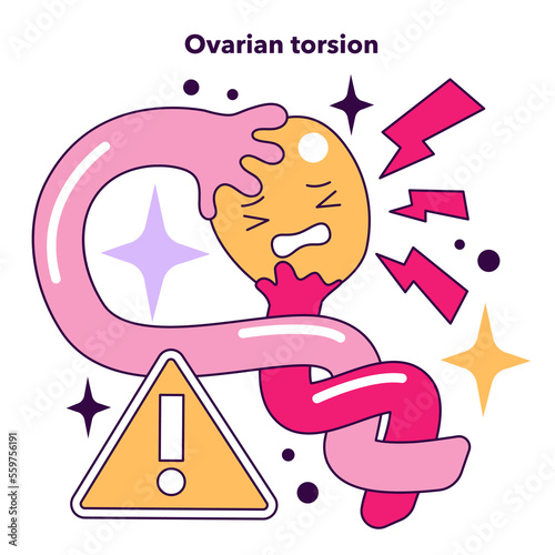 Ovarian torsion as a disadvantage of In vitro fertilization. Modern