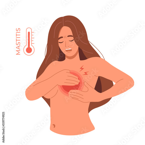 Vector woman with breast pain and fever as symptoms of mastitis. Female problem of breastfeeding. Sick girl holding her swollen breasts with ache and inflammation in nipple. Pumping and massage during