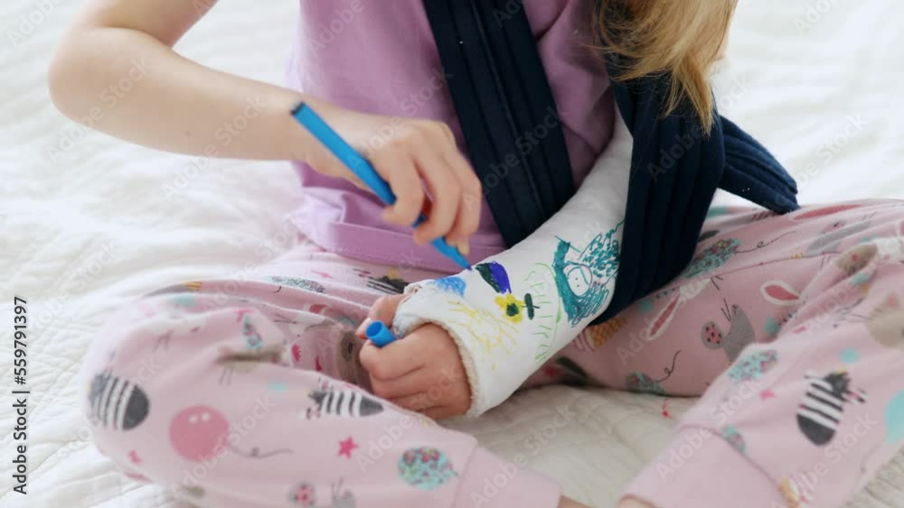 Adorable preschooler girl with a broken arm at home on the bed draws with felt-tip pens on an orthopedic cast. How to have fun with a broken limb. Broken arm in a cast in kids Adorable preschooler girl with a broken arm at home on the bed draws with felt-tip pens on an orthopedic cast. How to have fun with a broken limb. Broken arm in a cast in kids