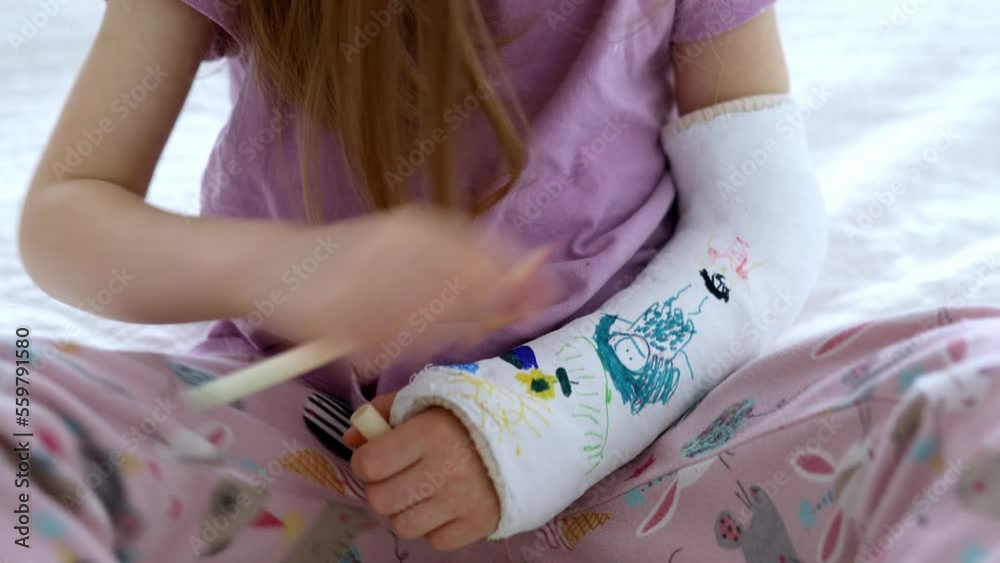 Adorable preschooler girl with a broken arm at home on the bed draws with felt-tip pens on an orthopedic cast. How to have fun with a broken limb. Broken arm in a cast in kids Adorable preschooler girl with a broken arm at home on the bed draws with felt-tip pens on an orthopedic cast. How to have fun with a broken limb. Broken arm in a cast in kids