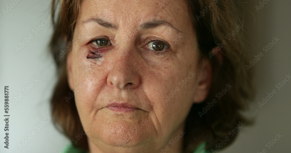 Older woman with beaten face and with scar shaking head with disapproval Older woman with beaten face and with scar shaking head with disapproval
