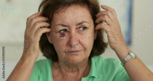 Foto Older woman with bruised face adjusting hair