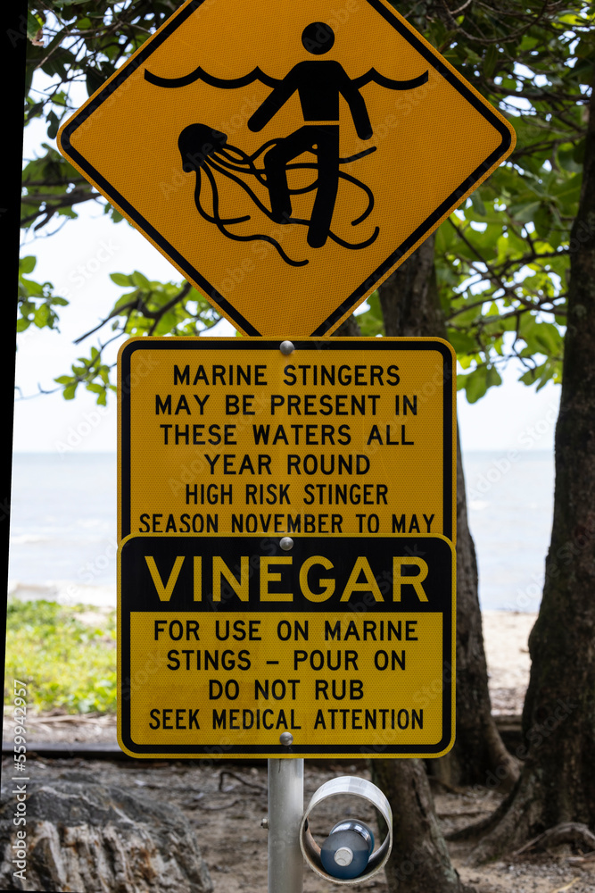 Marine Stinger bay on Far North Queensland Beach with vinegar for