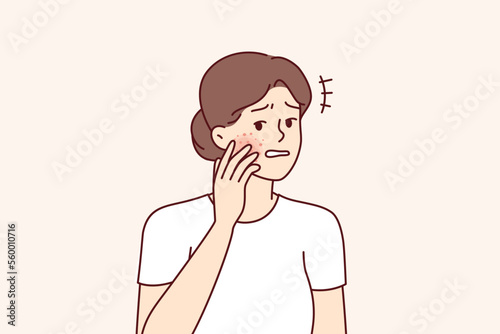 Unhappy woman gets frightened after seeing redness on face suffering from allergies. Perplexed girl with rash or pimples on skin experiencing anxiety and pain due to skin diseases. Flat vector design 