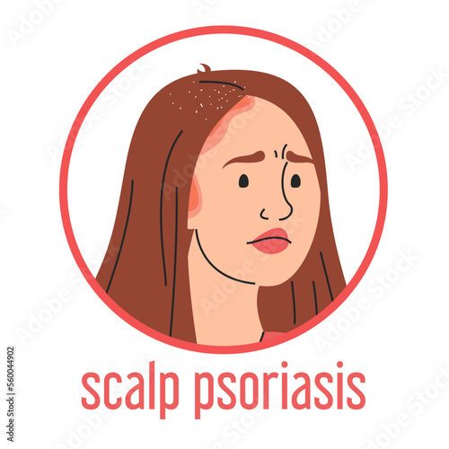 Scalp psoriasis vector isolated. Medical condition, dermatology disease. Sad woman with red itchy spots on the head and dandruff