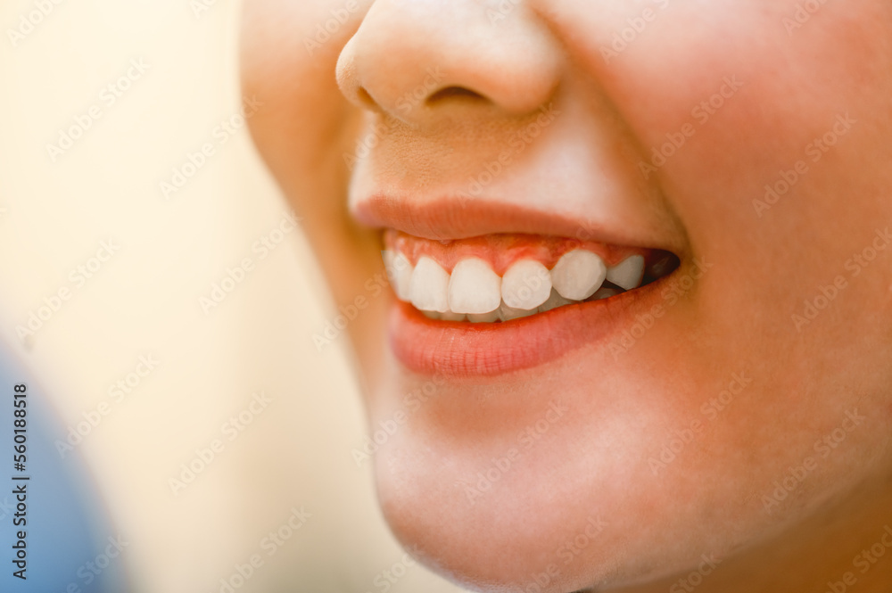 Fototapeta premium Close up smiling in dental clinic.Dentist examining teeth patients in clinic for better dental health and a bright smile.Hygienist concept of a healthy and beautiful smile.