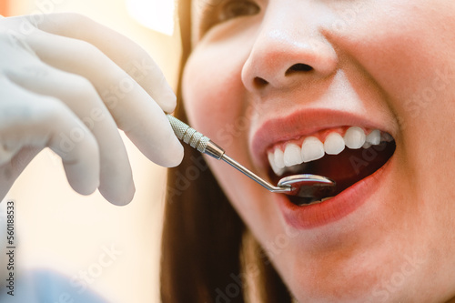 Close up smiling in dental clinic.Dentist examining teeth patients in clinic for better dental health and a bright smile.Hygienist concept of a healthy and beautiful smile.