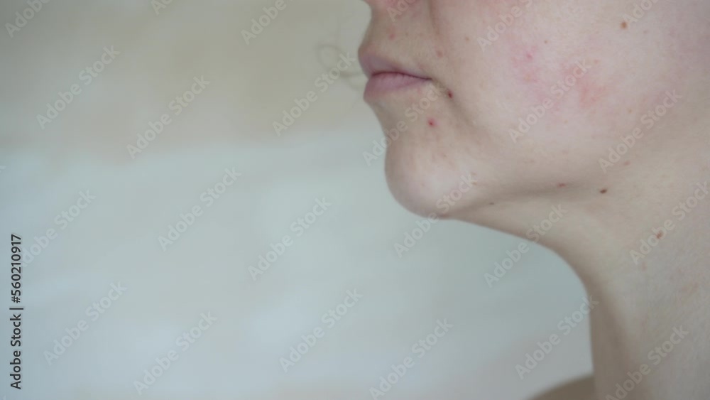 Close-up of a woman's face with a double chin on a plain background, side view. The concept of cosmetology, correction of the chin line.