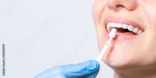 Banner tooth whitening, perfect white teeth close up with shade guide bleach color, female veneer smile, dental care and stomatology, dentistry, copyspace.
