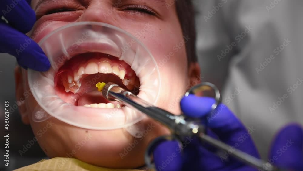 Closeup dentist using syringe with anesthetic, making injection of