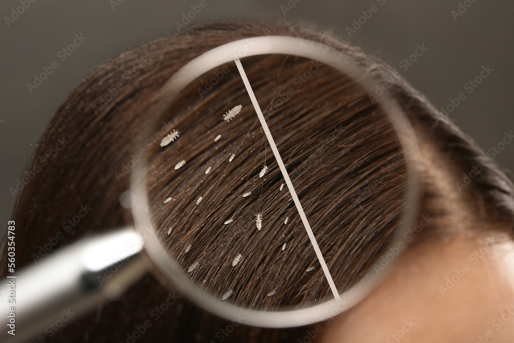 Collage showing woman's hair before and after lice treatment on grey