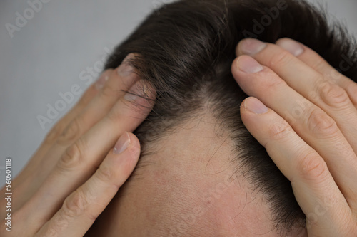 Young man touches hair with hands worrying about baldness. Concerned male person fights with alopecia standing against grey wall in room closeup
