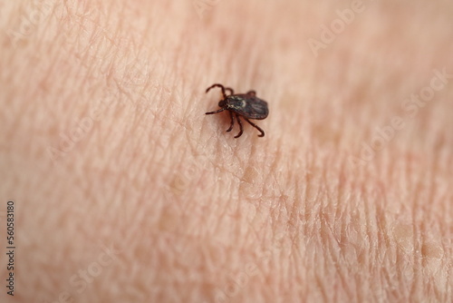 mite,Ixodid, encephalitic live tick on the human body close-up, macro photography.