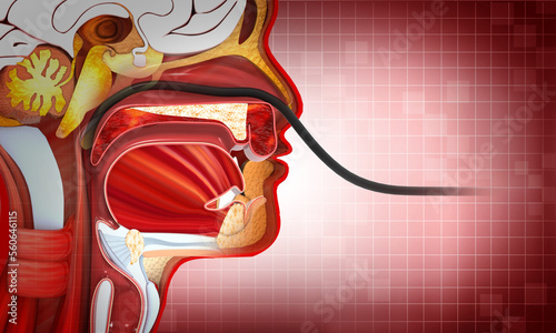 Nasogastric tube passed through the nose to stomach. 3d illustration