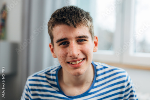 Portrait of a happy young adolescent boy with pimples