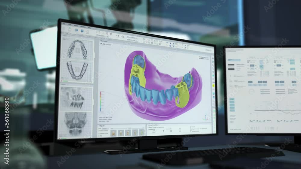 Medical program display manufacturing the dental restorations. Medical ...