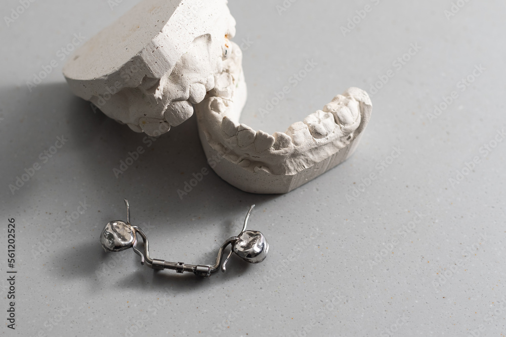 Plaster models of dental prostheses. Demonstration models of dentures
