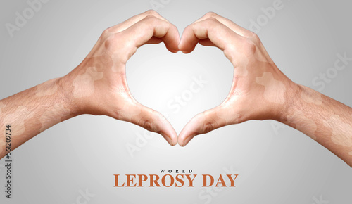 Vászonkép World leprosy day creative poster with heart shaped leprosy hands