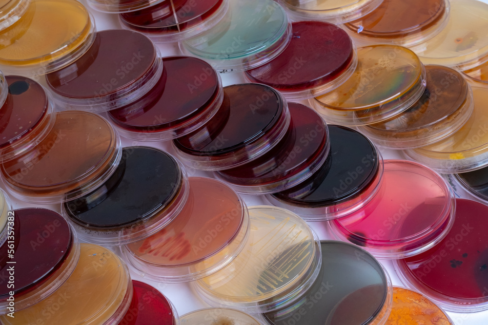 photo of bacteria and fungi growth on culture media in plastic plates ...