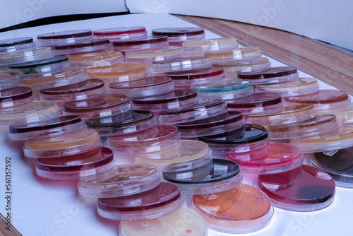 photo of bacteria and fungi growth on culture media in plastic plates photo