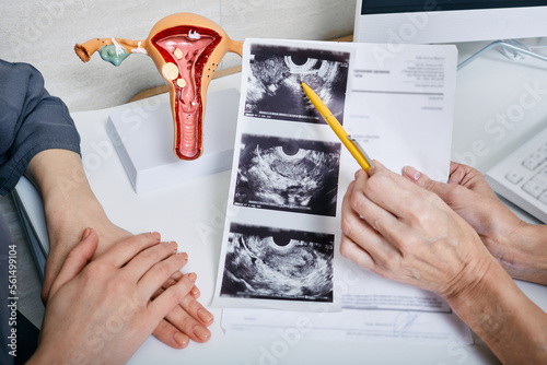 Gynecology, women's health. Gynecologist showing to woman ultrasound of her ovaries while visit to gynecology photo