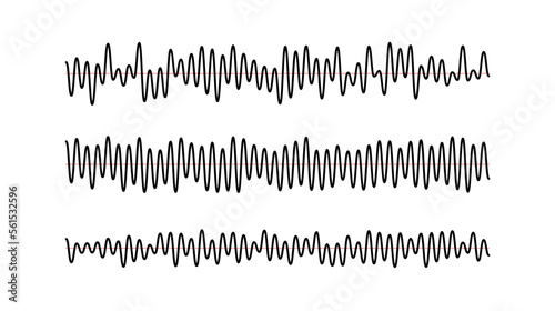 Sound wave signals set. Black audio track beats diagram collection. Voice or music sample concept. Pulse lines. Electronic radio graphics with different frequency and amplitude.