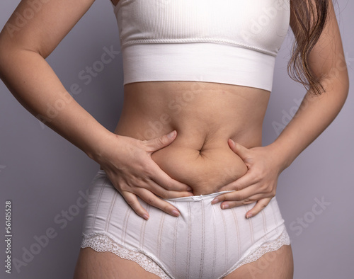 Fat woman hand holding excessive belly fat. Healthcare and woman diet lifestyle concept to reduce belly and shape up healthy stomach muscle. Cellulite.