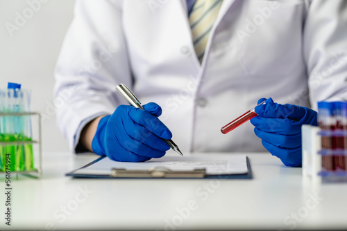 Doctor's hands in medical gloves holding a test tube with red blood for the sagittal microscopic test in the hematology laboratory at the hospital