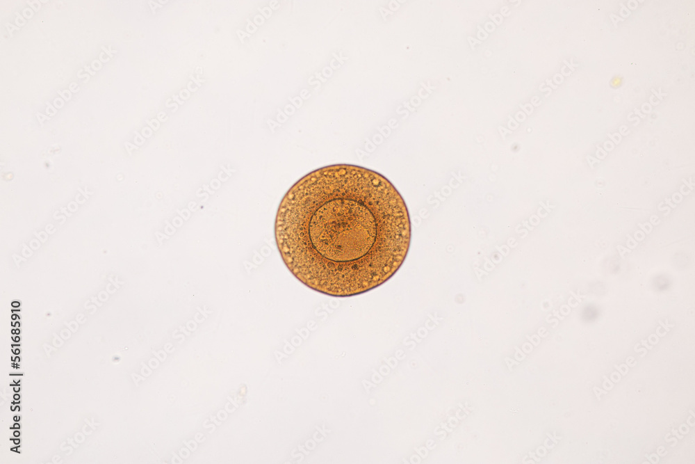 Study of protozoa and plant cells under the microscope for education ...