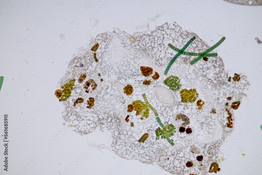 Foto de Study of protozoa and plant cells under the microscope for ...