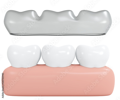 3D Rendering invisalign teeth with gum icon cartoon style isolated on white. 3D Render illustration.