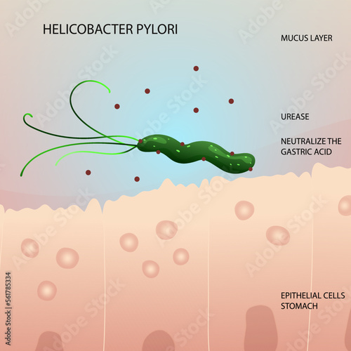 Helicobacter pylori on epithelial cells in human stomach illustration photo
