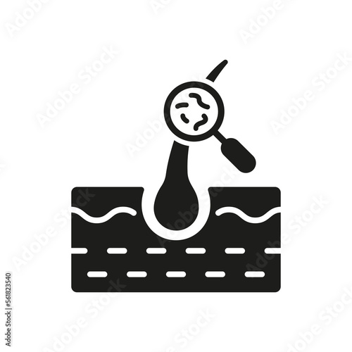 Hair Treatment Silhouette Icon. Lice Magnifying on Skin Glyph Pictogram. Health Care, Hygiene Head Skincare. Medical Problem in Hair Follicle Icon. Isolated Vector Illustration