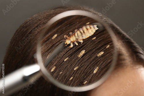 Obraz na plátně Pediculosis