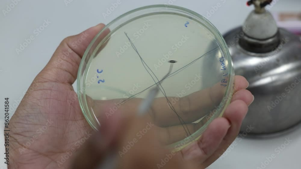 Cultivation of on agar medium plate in microbiology