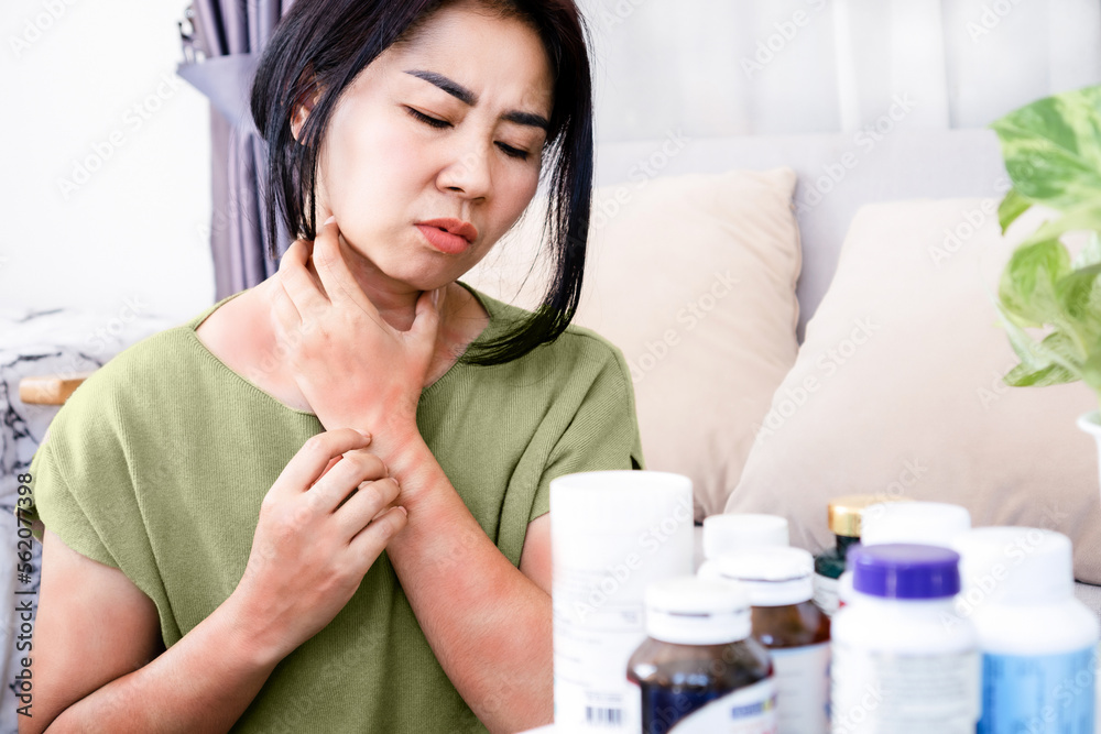 Asian woman have allergic reactions to supplements, multivitamins hand scratching on itchy, rash skin that has side effects with many bottles of drugs - obrazy, fototapety, plakaty 