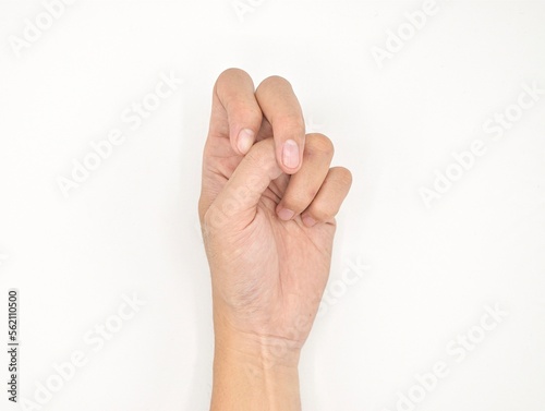 Cerebral palsy hand in Southeast Asian young male patient. Typically seen in hemiplegia and quadriplegia. Wrist joint flexion with ulnar deviation.