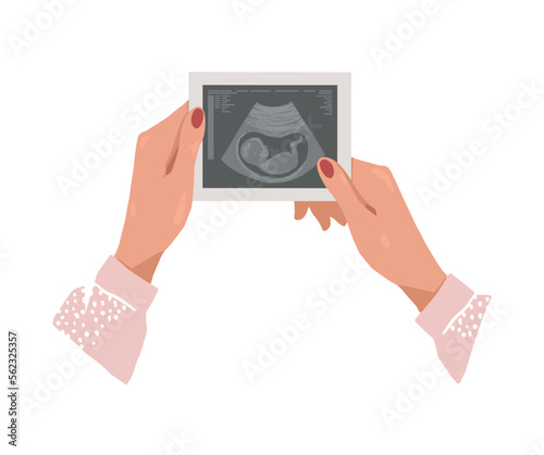 Woman holding baby ultrasound scan in her hands, pregnancy vector illustration. Healthy pregnancy, support for young mothers, medical care and examination. Flat illustration isolated 