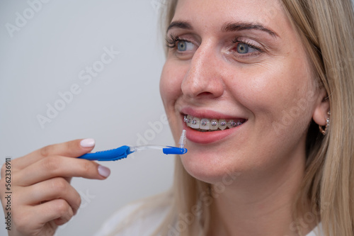 Caucasian woman cleaning her teeth with braces using a brush. 