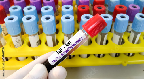 Blood sample for follicle stimulating hormone (FSH) test. photo