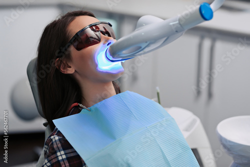 Teeth whitening for woman. Bleaching of the teeth at dentist clinic.
