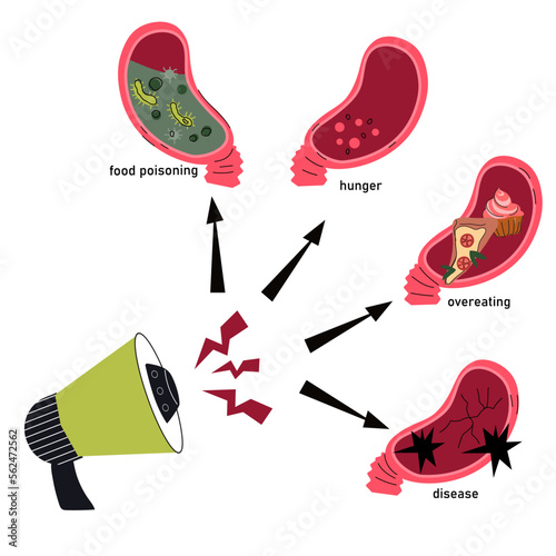 Gastritis and abdominal pain causes info graphic banner, flat cartoon vector illustration isolated on white background. Indigestion and stomach ache causes medical poster template.