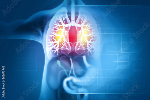Chronic obstructive pulmonary disease, respiratory diseases, 3d illustration. photo
