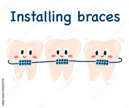 
Installing braces. Cute cartoon teeth with braces. Cheerful icons. Straightening teeth. Correction of byte. Dentistry. Orthodontics. Dental care. Metal braces. Straight teeth. Vector illustration
