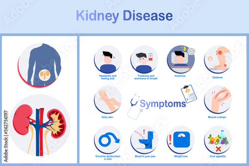 Symptoms of kidney disease, vector illustration, flat design