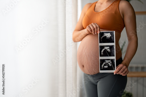 Unrecognizable pregnant woman with stretch marks in comfortable clothes showing her belly and sonographic images of her unborn baby, standing by the window at home during the day. photo