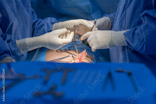 Surgeon inside modern operating room in hospital.Doctor in blue surgical gown suit with mask protection.Medical concept.Doctor with scrub nurse team perform hernia repair surgery.